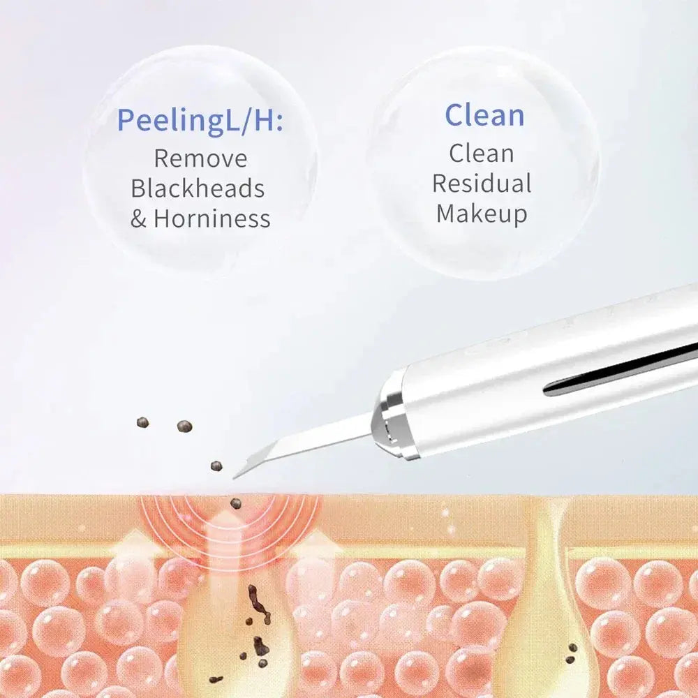 Electric Skin Scrubber Peeling Blackhead Remover.